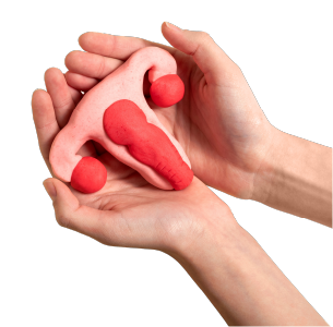 Гистероскопическое удаление полипа матки — комплекс за 53 000 ₽