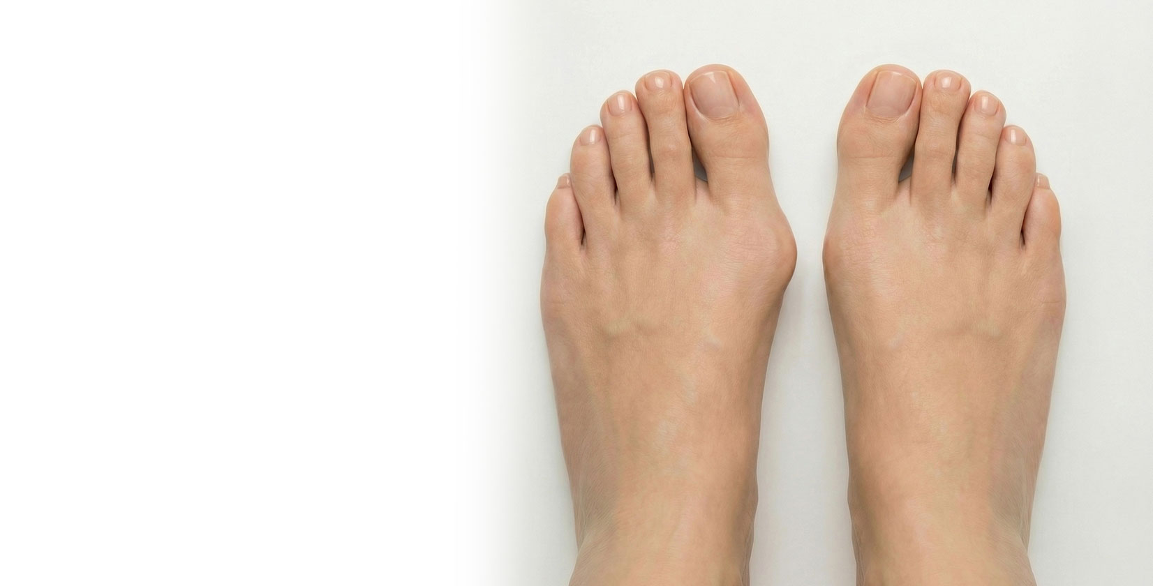 Диагностика стопы при вальгусной деформации