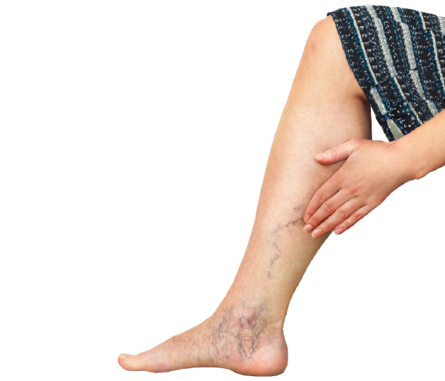 Полная диагностика вен у флеболога с УЗИ