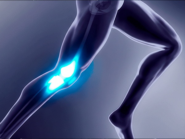 Перелом надколенника