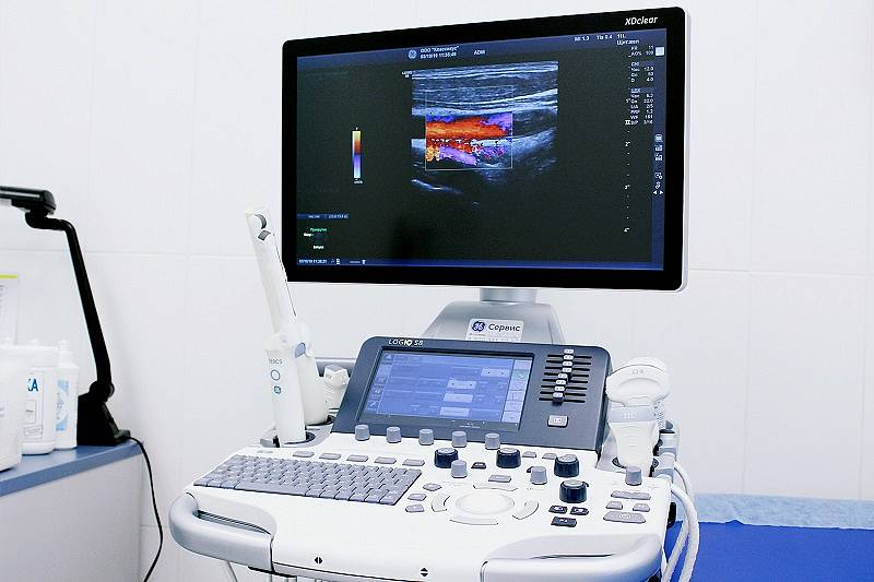 Диагностическая ультразвуковая система Voluson S8 GE