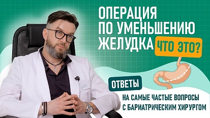 Что такое УМЕНЬШЕНИЕ желудка? Бариатрический хирург «Бест Клиник» Качурин Сергей Александрович 2