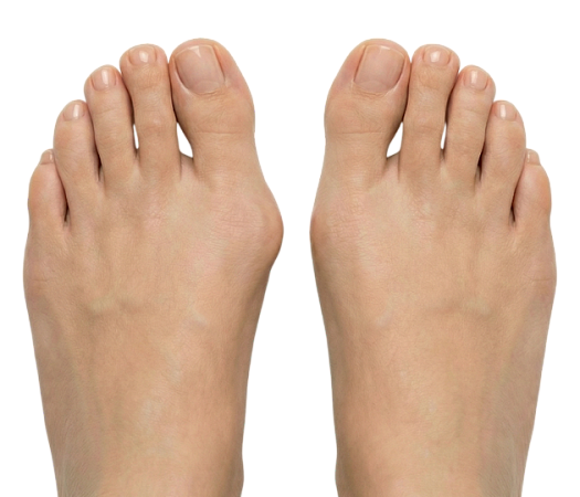 Диагностика стопы при вальгусной деформации