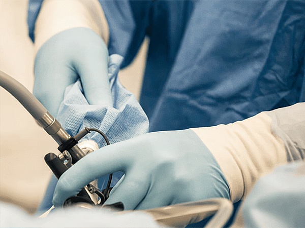 Аппендицит