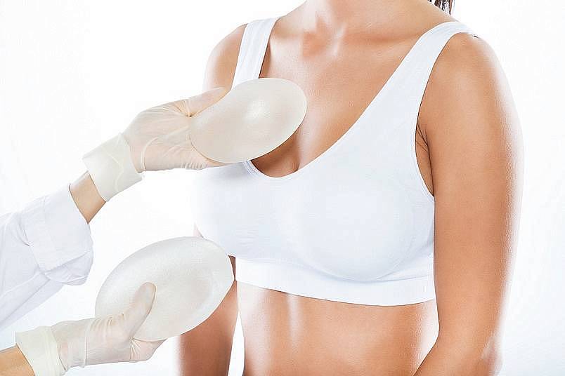 Маммопластика — увеличение груди