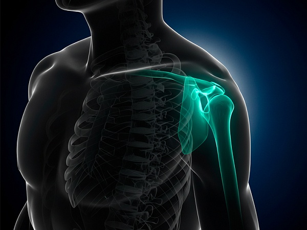 Лечение повреждений акромиально-ключичного сустава