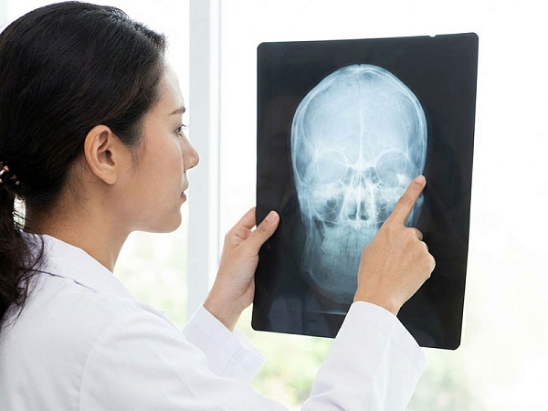 Внутричерепное давление