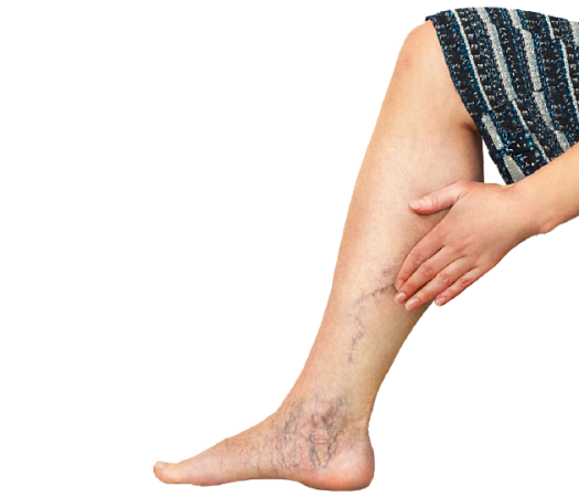 Полная диагностика вен у флеболога с УЗИ