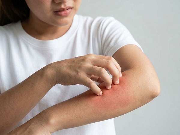 Токсико-аллергические реакции